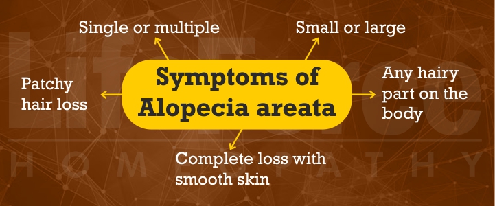 Symptoms of alopecia areata